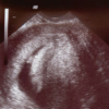Thumbnail image for Ten Things You Never Wanted To Know About the First Trimester